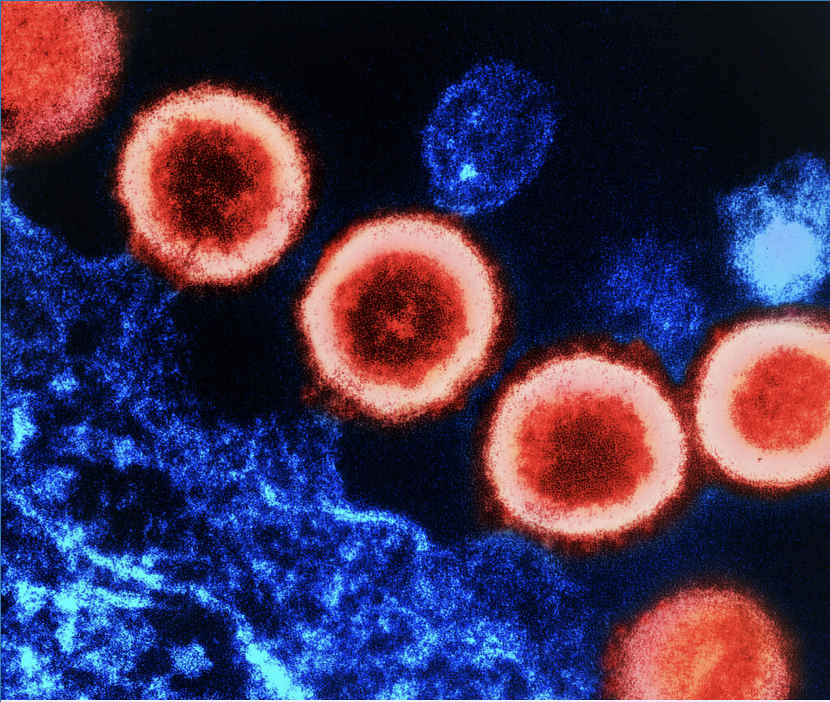 A close up picture of the HIV bacteria. Redbig circles with a blue background.